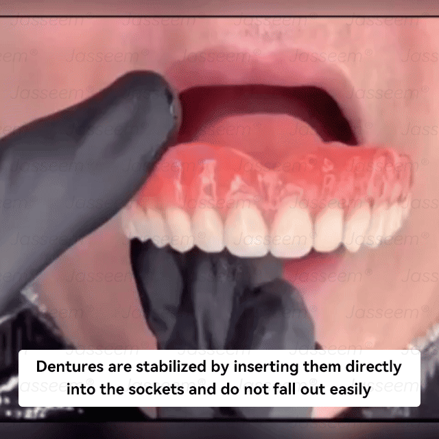 ๐๐๐ฌ๐ฌ๐๐๐ฆยฎ Latest Premium Comfort Dentures๐ง (High-End Dentures, Easy to Wear - Limited Time 70% Off)๐ฅ