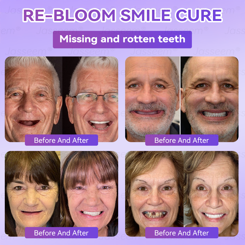 ๐๐๐ฌ๐ฌ๐๐๐ฆยฎ Latest Premium Comfort Dentures๐ง (High-End Dentures, Easy to Wear - Limited Time 70% Off)๐ฅ