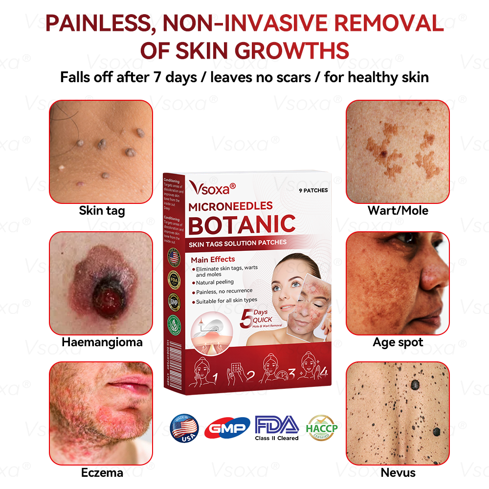 𝑉𝑠𝑜𝑥𝑎® 💧Microneedles Botanical Skin Tags Solution Patches - Made in the USA👩⚕️