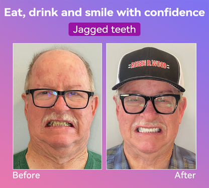 𝐉𝐚𝐬𝐬𝐞𝐞𝐦® Latest Premium Comfort Dentures🎁(High-End Dentures, Easy to Wear - Limited Time 70% Discount)