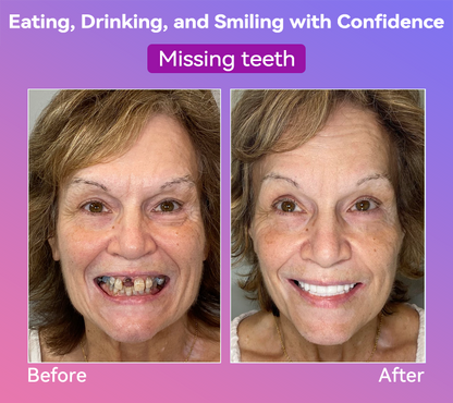 𝐉𝐚𝐬𝐬𝐞𝐞𝐦® Latest Premium Comfort Dentures🎁(High-End Dentures, Easy to Wear - Limited Time 70% Discount)