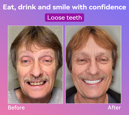 𝐉𝐚𝐬𝐬𝐞𝐞𝐦® Latest Premium Comfort Dentures🎁(High-End Dentures, Easy to Wear - Limited Time 70% Discount)