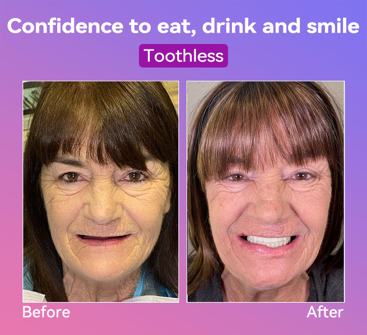 𝐉𝐚𝐬𝐬𝐞𝐞𝐦® Latest Premium Comfort Dentures🎁(High-End Dentures, Easy to Wear - Limited Time 70% Discount)