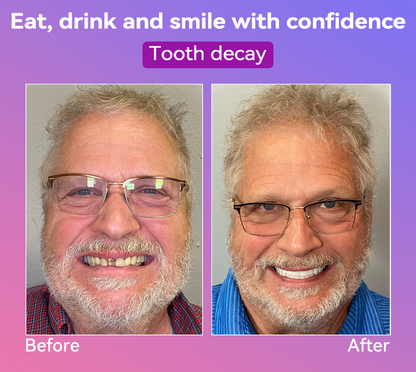 𝐉𝐚𝐬𝐬𝐞𝐞𝐦® Latest Premium Comfort Dentures🎁(High-End Dentures, Easy to Wear - Limited Time 70% Discount)