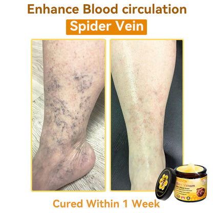 𝐃𝐨𝐫𝐦𝐨𝐫𝐧𝐚®💧Bee Venom Repair Cream (Anti-aging, deep hydration, skin repair, even skin tone, acne and dark spot treatment, removal of warts and moles, and psoriasis relief)