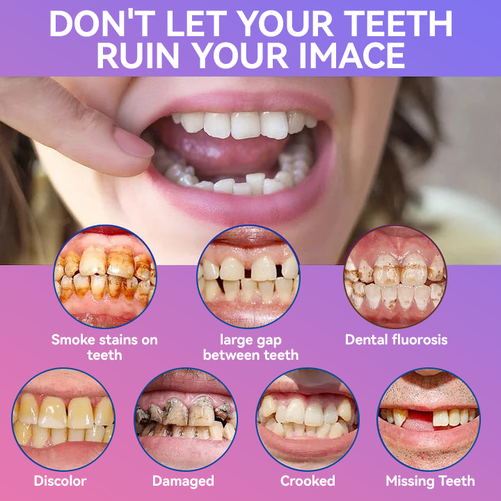 𝐉𝐚𝐬𝐬𝐞𝐞𝐦® Latest Premium Comfort Dentures🎁(High-End Dentures, Easy to Wear - Limited Time 70% Discount)