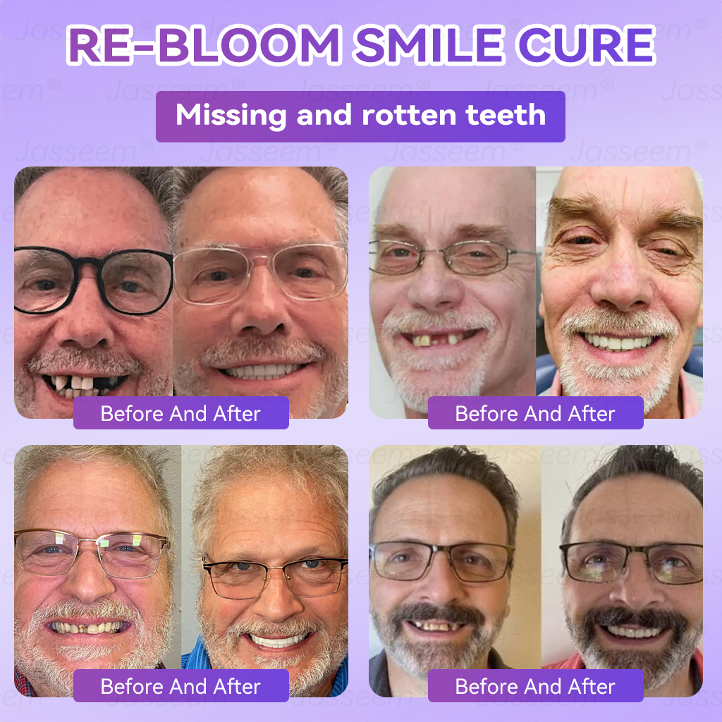 𝐉𝐚𝐬𝐬𝐞𝐞𝐦® Latest Premium Comfort Dentures💧 (High-End Dentures, Easy to Wear - Limited Time 70% Off)🔥