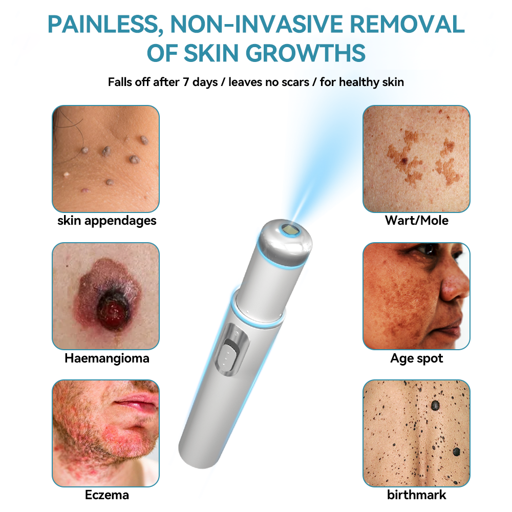 𝐉𝐚𝐬𝐬𝐞𝐞𝐦® Medical-Grade Laser Pen 🚚🎁(Powered by CO₂ laser technology – effectively removes moles, warts, skin tags, pigmentation marks, and other skin imperfections)