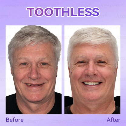 𝐉𝐚𝐬𝐬𝐞𝐞𝐦® Latest Premium Comfort Dentures💧 (High-End Dentures, Easy to Wear - Limited Time 70% Off)🔥