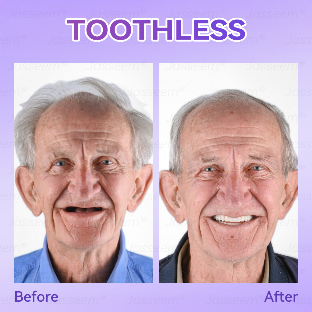 𝐉𝐚𝐬𝐬𝐞𝐞𝐦® Latest Premium Comfort Dentures💧 (High-End Dentures, Easy to Wear - Limited Time 70% Off)🔥